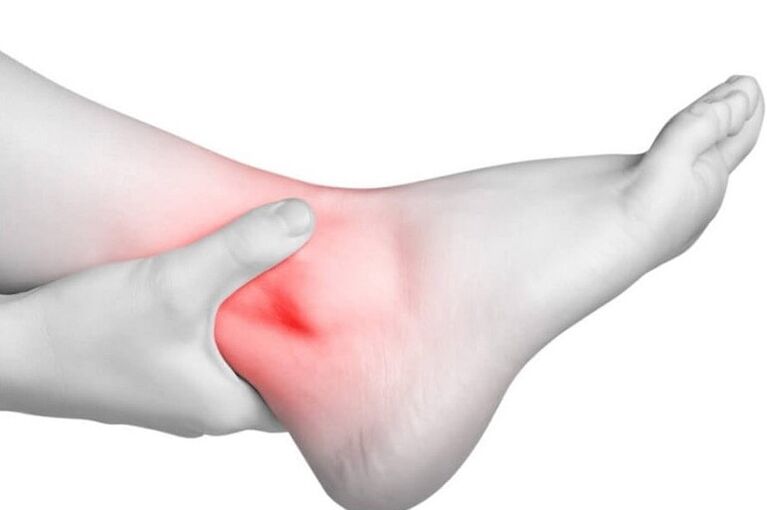 Inflammation of the joint with gout